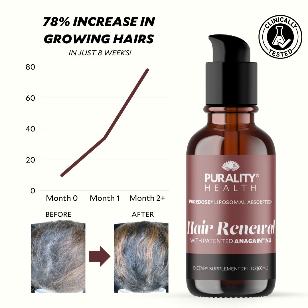 78% Increase In Growing Hairs